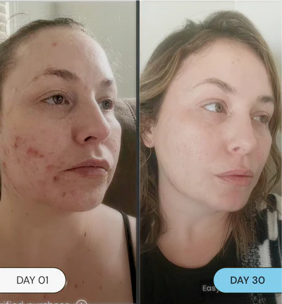 It doesn’t sit on top of your skin. It sinks in.