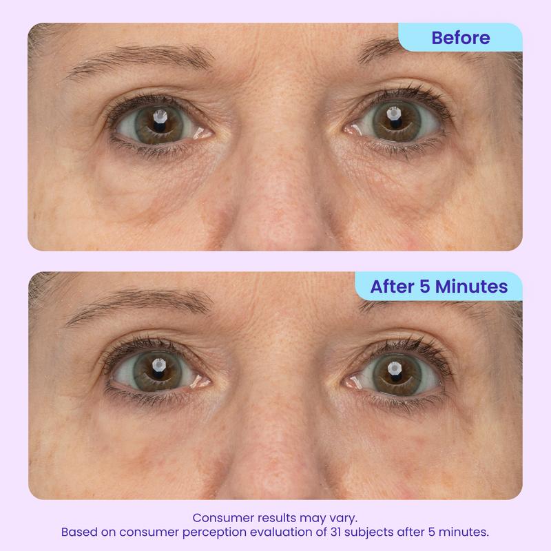Lussara 5-Min Eye Lift Gel