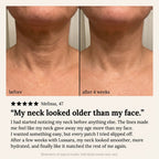 Glass Neck Hydrogel Patch