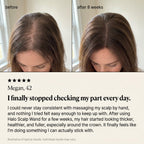 Halo Scalp Wand