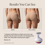 Lussara Vacuum Sculpting Massager