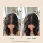 Halo Scalp Wand