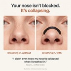 Lussara Magnetic Nasal Strips