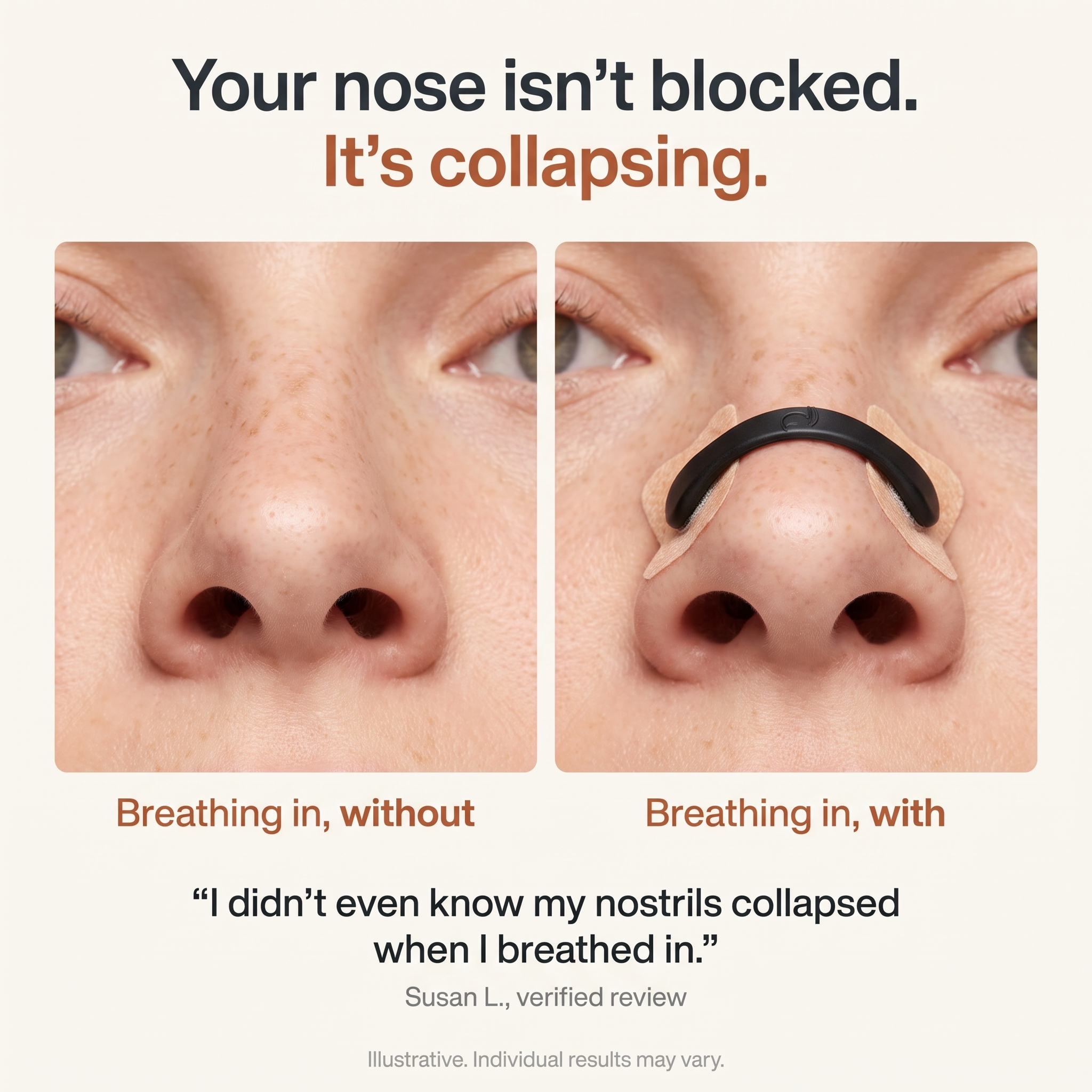 Lussara Magnetic Nasal Strips