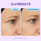 Lussara 5-Min Eye Lift Gel