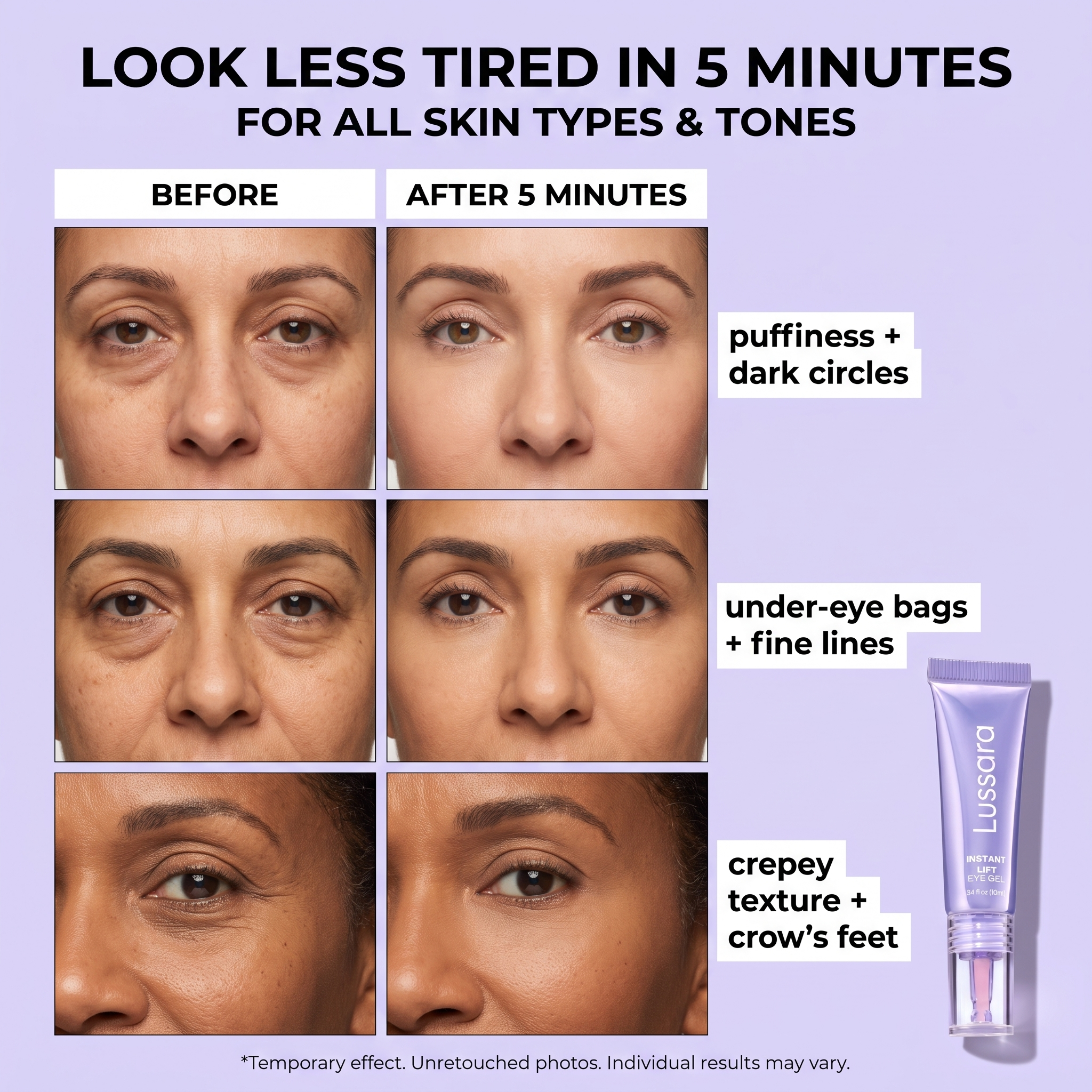 Lussara 5-Min Eye Lift Gel