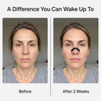 Lussara Magnetic Nasal Strips