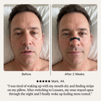 Lussara Magnetic Nasal Strips