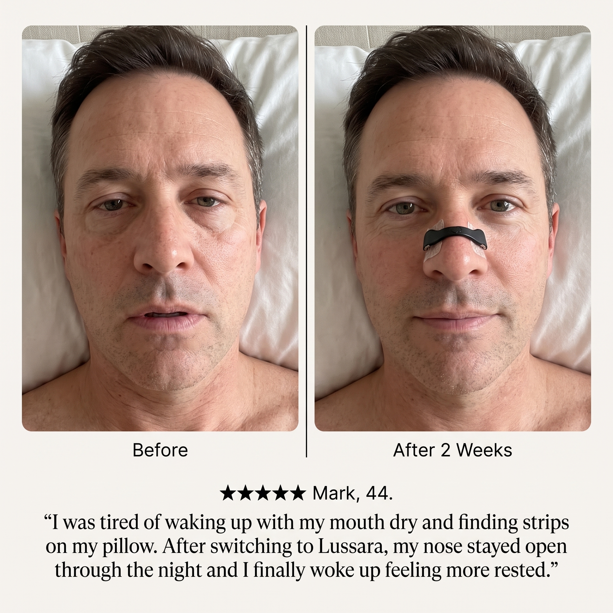 Lussara Magnetic Nasal Strips