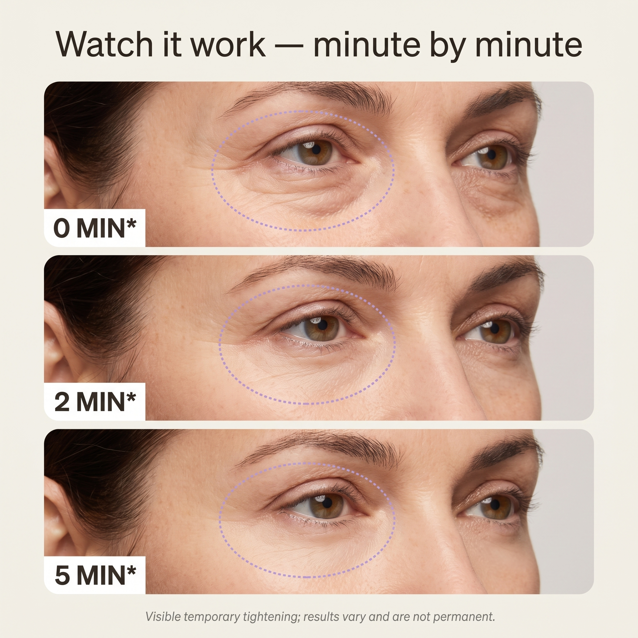 Lussara 5-Min Eye Lift Gel