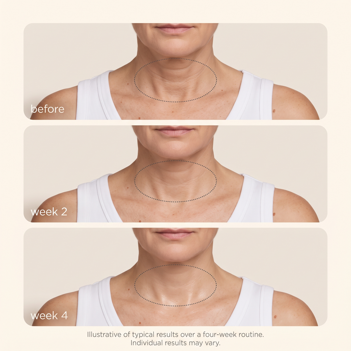 Glass Neck Hydrogel Patch